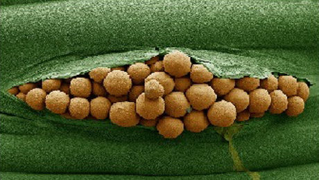 Fungicyd Elatus Era - pod mikroskopem